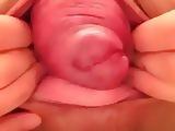 japanese girl close up prolapse pussy 